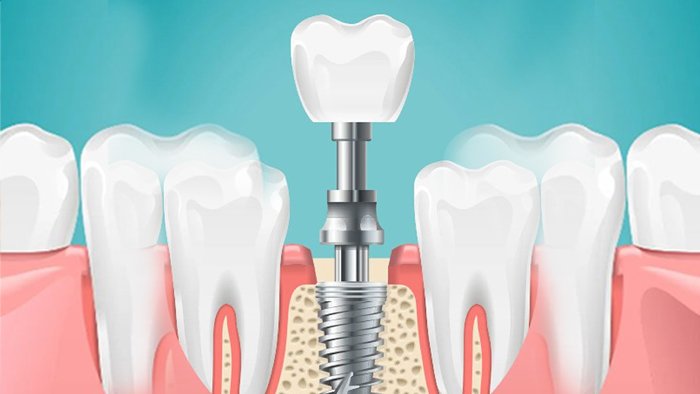 Dental